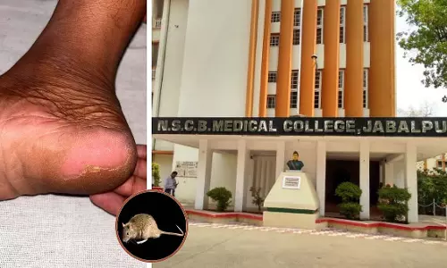 Jabalpur : नेताजी सुभाष चंद्र बोस मेडिकल कॉलेज में रात में चूहों ने मरीजों के पैर काटे Jabalpur : नेताजी सुभाष चंद्र बोस मेडिकल कॉलेज में रात में चूहों ने मरीजों के पैर काटे