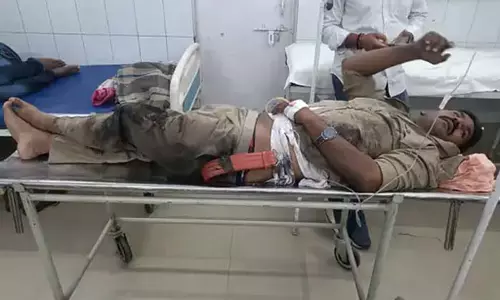 कचहरी में दरोगा पर हमला: वर्दी फाड़ी, सिर-चेहरे पर गहरे घाव, प्रशासन अलर्ट