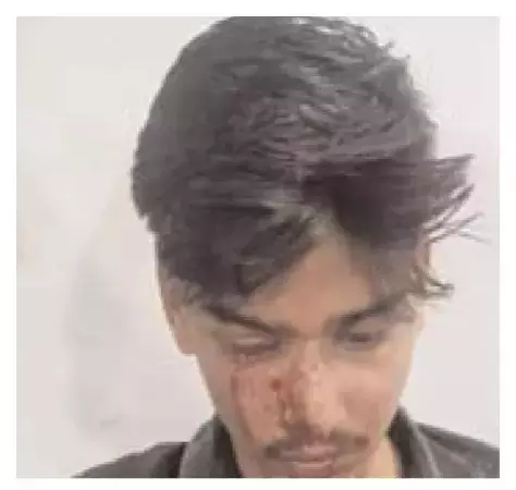 Bareilly: दरोगा की कार्रवाई में डिलीवरी ब्वॉय गंभीर रूप से घायल Bareilly: दरोगा की कार्रवाई में डिलीवरी ब्वॉय गंभीर रूप से घायल