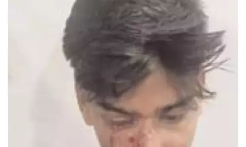 Bareilly: दरोगा की कार्रवाई में डिलीवरी ब्वॉय गंभीर रूप से घायल