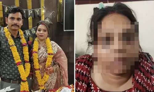 MP : दहेज के लिए पत्नी पर बेरहमी से हमला करने के आरोप में पुलिस कांस्टेबल पर मामला दर्ज