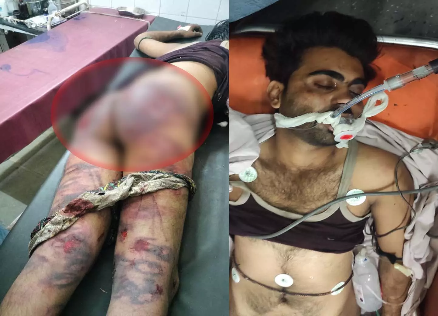 मन्दसौर निवासी शेरु की कथित गौरक्षकों द्वारा लिंचिंग, अस्पताल में मौत मन्दसौर निवासी शेरु की कथित गौरक्षकों द्वारा लिंचिंग, अस्पताल में मौत