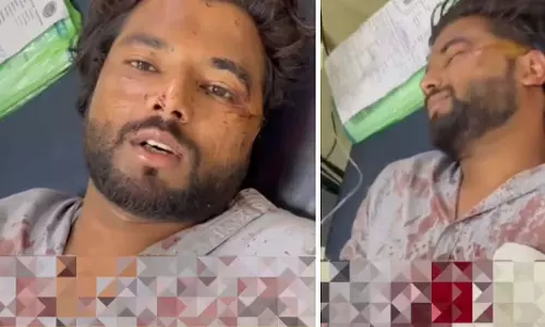 Bhopal : दुर्गा पूजा के चंदे को लेकर युवक की पिटाई, चाकू से हमला