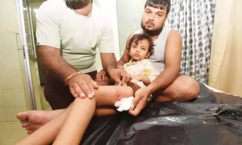 Kerala : आवारा कुत्तों ने चार लोगों को काटा, एक को लोमड़ी ने काटा