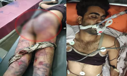 मन्दसौर निवासी शेरु की कथित गौरक्षकों द्वारा लिंचिंग, अस्पताल में मौत मन्दसौर निवासी शेरु की कथित गौरक्षकों द्वारा लिंचिंग, अस्पताल में मौत
