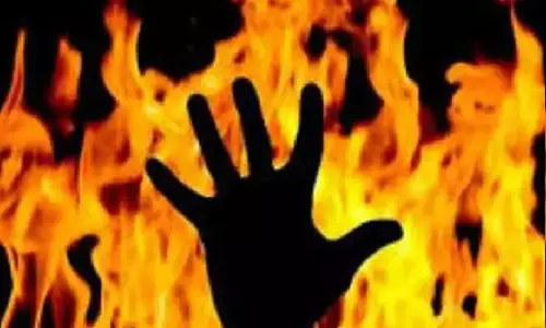 महिला ने खुद को लगाई आग, पति ने बीजेपी विधायक पर लगाया प्रताड़ना का आरोप