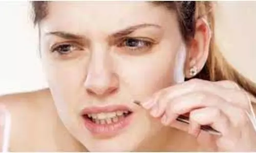 Beauty Tips :चेहरे से अनचाहे बाल हटाने के घरेलू उपाय