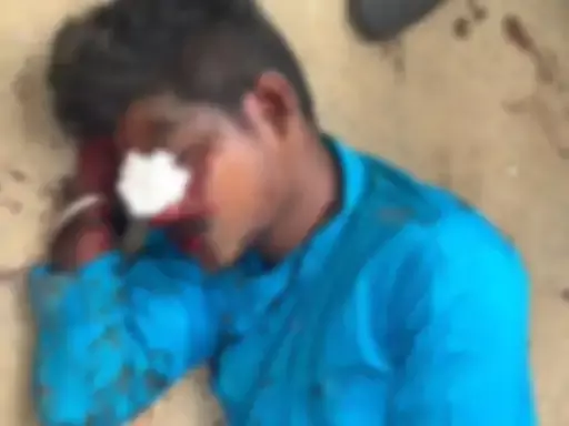 स्कूल बस छोड़कर ड्राइवर फरार, ठोकर से बाइक सवार घायल स्कूल बस छोड़कर ड्राइवर फरार, ठोकर से बाइक सवार घायल