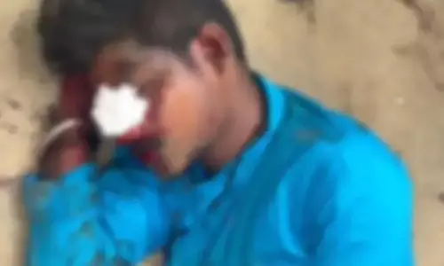 स्कूल बस छोड़कर ड्राइवर फरार, ठोकर से बाइक सवार घायल