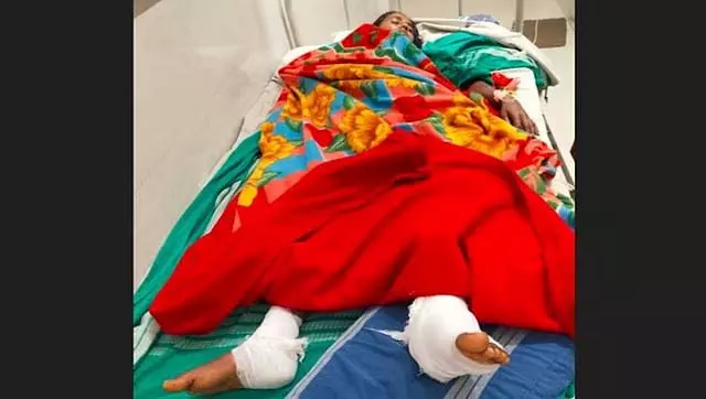 HIMS डॉक्टर की गलती; महिला के बाएं पैर की बजाय दाएं पैर की सर्जरी HIMS डॉक्टर की गलती; महिला के बाएं पैर की बजाय दाएं पैर की सर्जरी