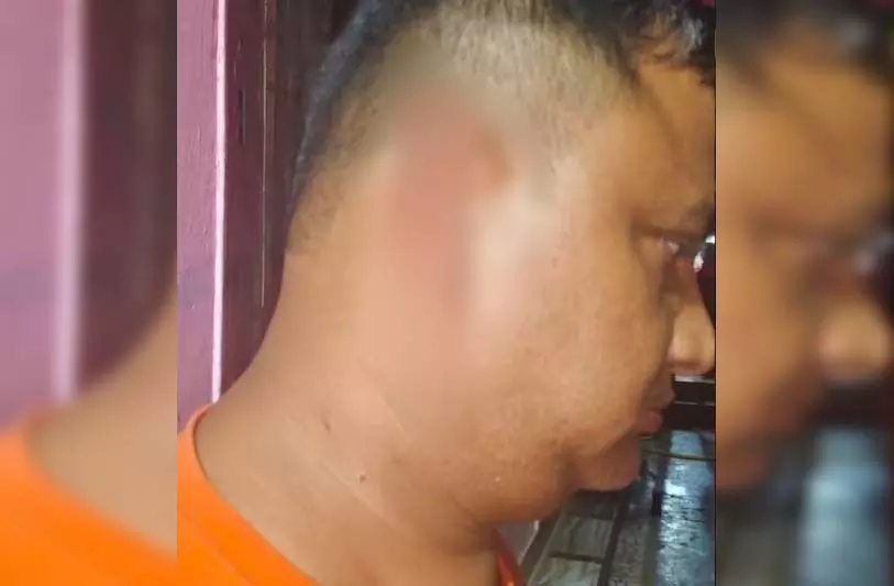 ऐसी भी क्या लड़ाई! पत्नी ने गुस्से में कुछ भयानक कर डाला...पति की निकली चीख ऐसी भी क्या लड़ाई! पत्नी ने गुस्से में कुछ भयानक कर डाला...पति की निकली चीख