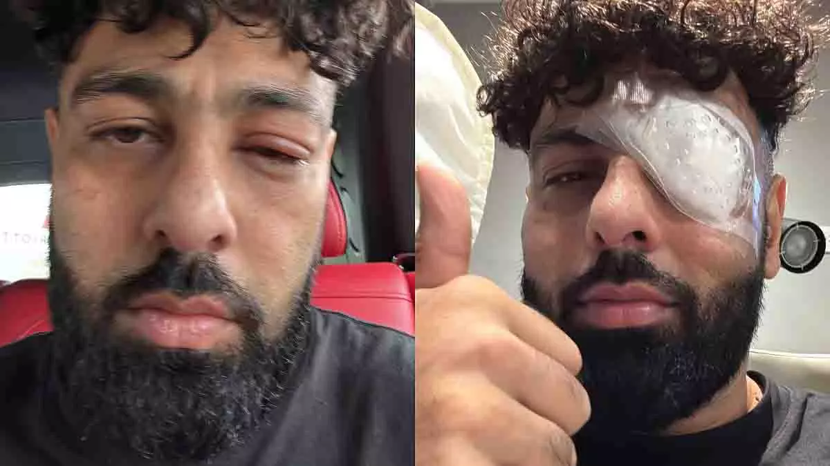 Badshah की आंख की सर्जरी, मंच पर लगी थी चोट Badshah की आंख की सर्जरी, मंच पर लगी थी चोट