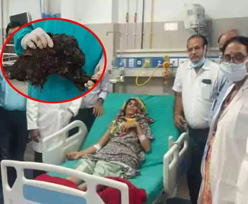 BREAKING: महिला के पेट से दूरबीन तकनीक से निकाला गया 6 किलो बालों का गुच्छा BREAKING: महिला के पेट से दूरबीन तकनीक से निकाला गया 6 किलो बालों का गुच्छा