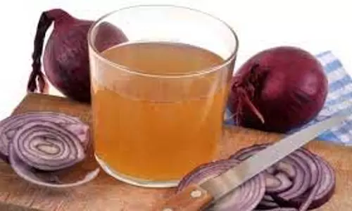 Hair Care: नए बाल उगाने में बेहद फायदेमंद है प्याज का रस, जानें इस्तेमाल के तीन बेहतरीन तरीके Hair Care: नए बाल उगाने में बेहद फायदेमंद है प्याज का रस, जानें इस्तेमाल के तीन बेहतरीन तरीके