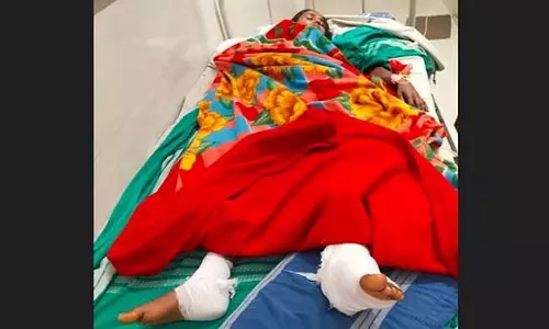 HIMS डॉक्टर की गलती; महिला के बाएं पैर की बजाय दाएं पैर की सर्जरी HIMS डॉक्टर की गलती; महिला के बाएं पैर की बजाय दाएं पैर की सर्जरी