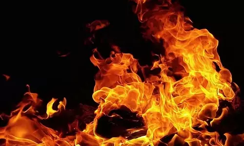 Mumbai : कांदिवली के अकुरली में गैस रिसाव से लगी आग में 7 लोग गंभीर रूप से झुलसे Mumbai : कांदिवली के अकुरली में गैस रिसाव से लगी आग में 7 लोग गंभीर रूप से झुलसे