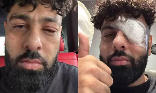 Badshah की आंख की सर्जरी, मंच पर लगी थी चोट