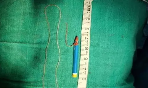 CG BREAKING: जेल में कैदी ने पेशाब की नली में पेंसिल फंसा ली, विभाग ने फैली सनसनी