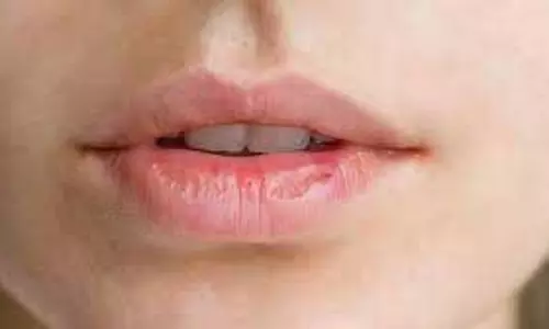 Beauty Tips:इन आसान लिप केयर हैक्स से पाएं मुलायम और प्राकृतिक चमक Beauty Tips:इन आसान लिप केयर हैक्स से पाएं मुलायम और प्राकृतिक चमक