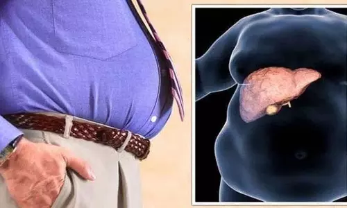 fatty liver से पीड़ित लोगों में क्या लक्षण दिखाई देते हैं? कौन से खाद्य पदार्थ खाने चाहिए?