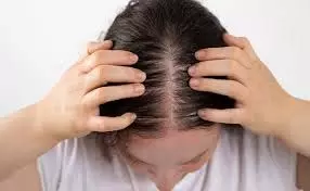 Hair care: आप भी बालों के झड़ने से परेशान हैं, तो प्याज के जादुई टोटके आजमाएं Hair care: आप भी बालों के झड़ने से परेशान हैं, तो प्याज के जादुई टोटके आजमाएं
