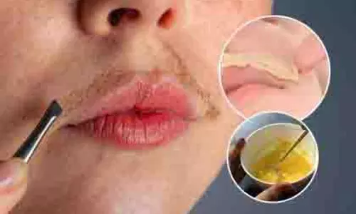 Beauty Tips: बेसन से प्राकृतिक रूप से ऊपरी होंठ के बाल कैसे हटाएं Beauty Tips: बेसन से प्राकृतिक रूप से ऊपरी होंठ के बाल कैसे हटाएं