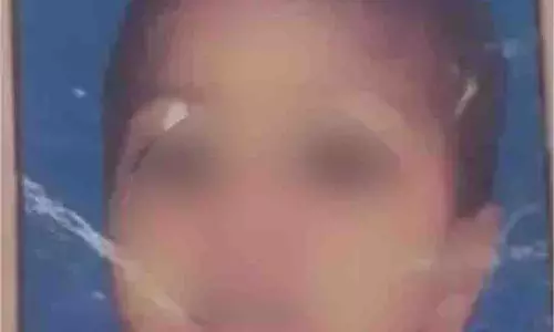 Up News : पटाखे से लगी आग से 8 साल के बच्चे की मौत
