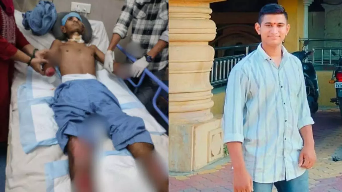 पंडाल स्थल पर बिजली का झटका लगने से पनवेल के किशोर के हाथ कटे, कोमा में गया पंडाल स्थल पर बिजली का झटका लगने से पनवेल के किशोर के हाथ कटे, कोमा में गया