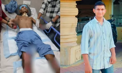 पंडाल स्थल पर बिजली का झटका लगने से पनवेल के किशोर के हाथ कटे, कोमा में गया पंडाल स्थल पर बिजली का झटका लगने से पनवेल के किशोर के हाथ कटे, कोमा में गया