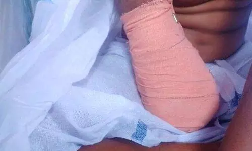 Kerala: पलक्कड़ जिला अस्पताल के डॉक्टरों को रिपोर्ट में नहीं मिली कोई गलती