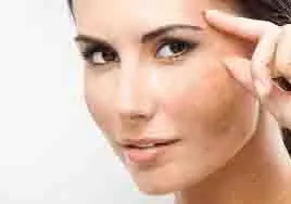 Beauty Tips:चेहरे की झाइयां मिटाए इन आसान घरेलू उपायों से Beauty Tips:चेहरे की झाइयां मिटाए इन आसान घरेलू उपायों से