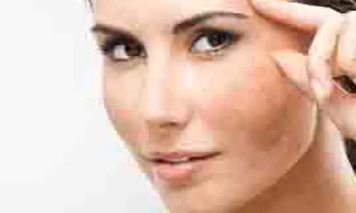 Beauty Tips:चेहरे की झाइयां मिटाए इन आसान घरेलू उपायों से Beauty Tips:चेहरे की झाइयां मिटाए इन आसान घरेलू उपायों से