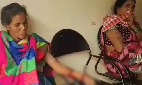 भालुओं ने मचाया आतंक, हमले से तीन ग्रामीण हॉस्पिटल में भर्ती भालुओं ने मचाया आतंक, हमले से तीन ग्रामीण हॉस्पिटल में भर्ती