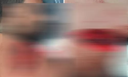 उरला में होटल संचालक पर चाकू से हमला, लूटपाट के बाद बदमाश फरार