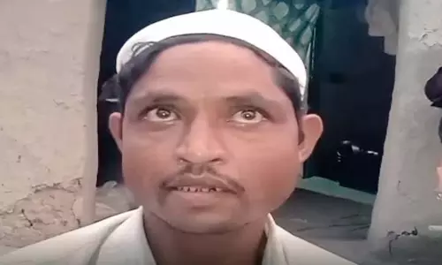 UP के एक व्यक्ति का दावा, उसकी पत्नी नागिन बन गई