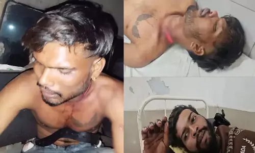 CG BREAKING: बिलासपुर में चाकूबाजी और सर्जिकल ब्लेड हमला, 2 युवक घायल