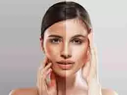 Remove Tan Naturally: नेचुरल तरीके से टैनिंग हटाएं और पाएं पार्लर जैसा ग्लोइंग निखार Remove Tan Naturally: नेचुरल तरीके से टैनिंग हटाएं और पाएं पार्लर जैसा ग्लोइंग निखार