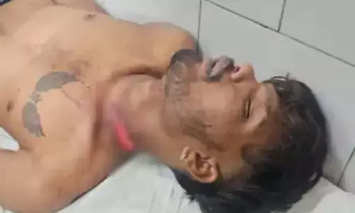 चोर बोलने पर गुस्सा हुआ युवक, गले पर चलाया सर्जिकल ब्लेड चोर बोलने पर गुस्सा हुआ युवक, गले पर चलाया सर्जिकल ब्लेड