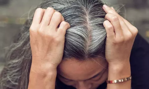 सफेद Hair को जड़ से काला करने के 5 असरदार घरेलू उपाय सफेद Hair को जड़ से काला करने के 5 असरदार घरेलू उपाय