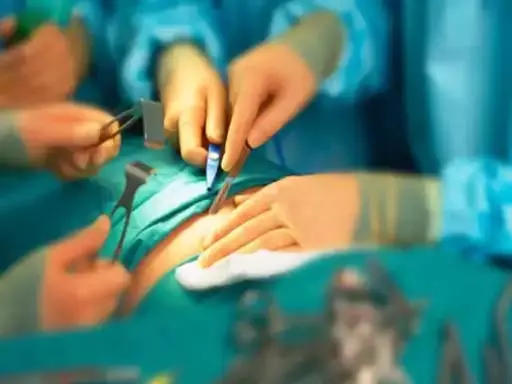 पेट में छिपा था 10 किलो का ट्यूमर, डॉक्टर्स बने देवदूत पेट में छिपा था 10 किलो का ट्यूमर, डॉक्टर्स बने देवदूत