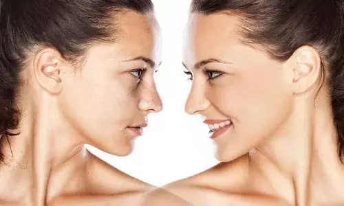 क्या आपके चेहरे पर अतिरिक्त चर्बी है? ये करें, समस्या कम हो जाएगी!