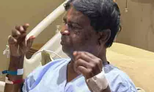 हमलावरों ने हमें मारने की योजना बनाई थी: घायल बंगाल BJP सांसद