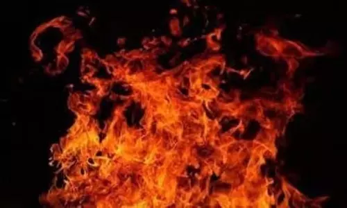 Bengaluru होटल में दंपति की जलकर मौत, आग लगने का कारण अज्ञात Bengaluru होटल में दंपति की जलकर मौत, आग लगने का कारण अज्ञात
