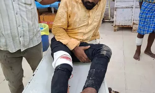 लड़की से बलात्कार; भागने की कोशिश कर रहे संदिग्ध को गोली मारी गई लड़की से बलात्कार; भागने की कोशिश कर रहे संदिग्ध को गोली मारी गई