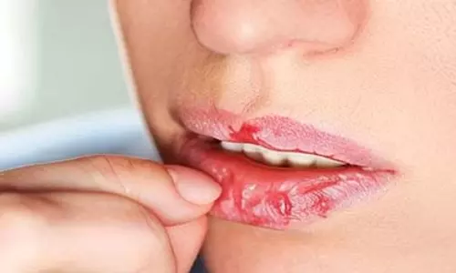 फटे होंठ और डबल चिन से हैं परेशान? ये एक्सरसाइज हैं कारगर