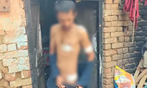 बहन से दूर रहने कहा भाई ने, तो सनकी युवक ने मारा चाकू