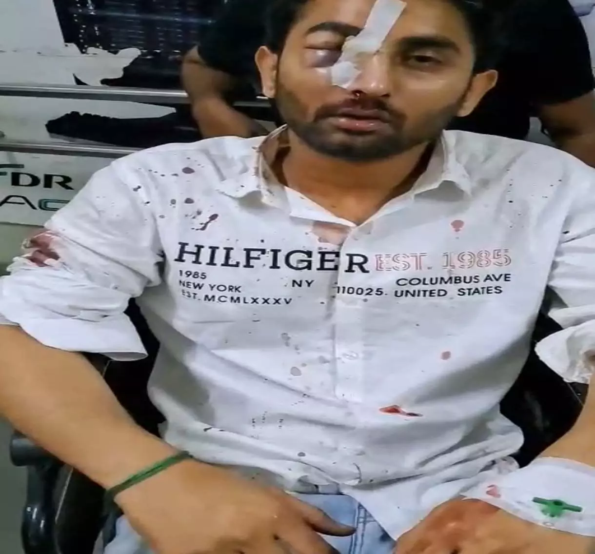 Raipur Breaking: दो पक्षों के बीच जमकर चले लाठी-डंडे और घूंसे, FIR दर्ज Raipur Breaking: दो पक्षों के बीच जमकर चले लाठी-डंडे और घूंसे, FIR दर्ज