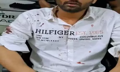 Raipur Breaking: दो पक्षों के बीच जमकर चले लाठी-डंडे और घूंसे, FIR दर्ज