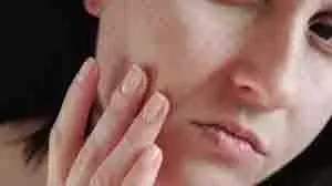 Skin Care: अगर आप अपनी त्वचा पर खुले रोमछिद्रों से परेशान हैं, तो इन घरेलू उपायों का इस्तेमाल करें Skin Care: अगर आप अपनी त्वचा पर खुले रोमछिद्रों से परेशान हैं, तो इन घरेलू उपायों का इस्तेमाल करें