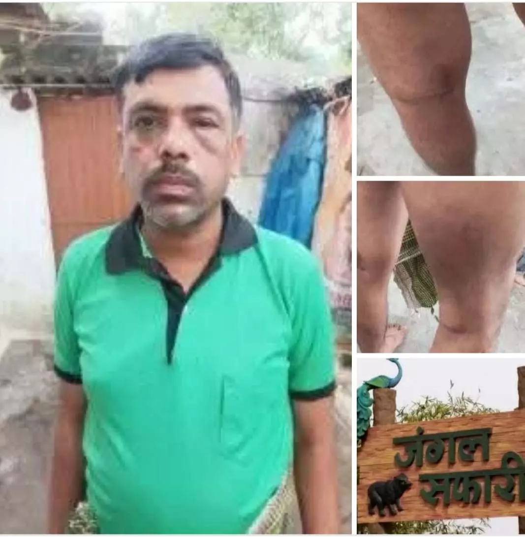 अधिकारी ने कर्मचारी को पुलिस से पिटवाया, आंख हाथ और पैर में सूजन अधिकारी ने कर्मचारी को पुलिस से पिटवाया, आंख हाथ और पैर में सूजन